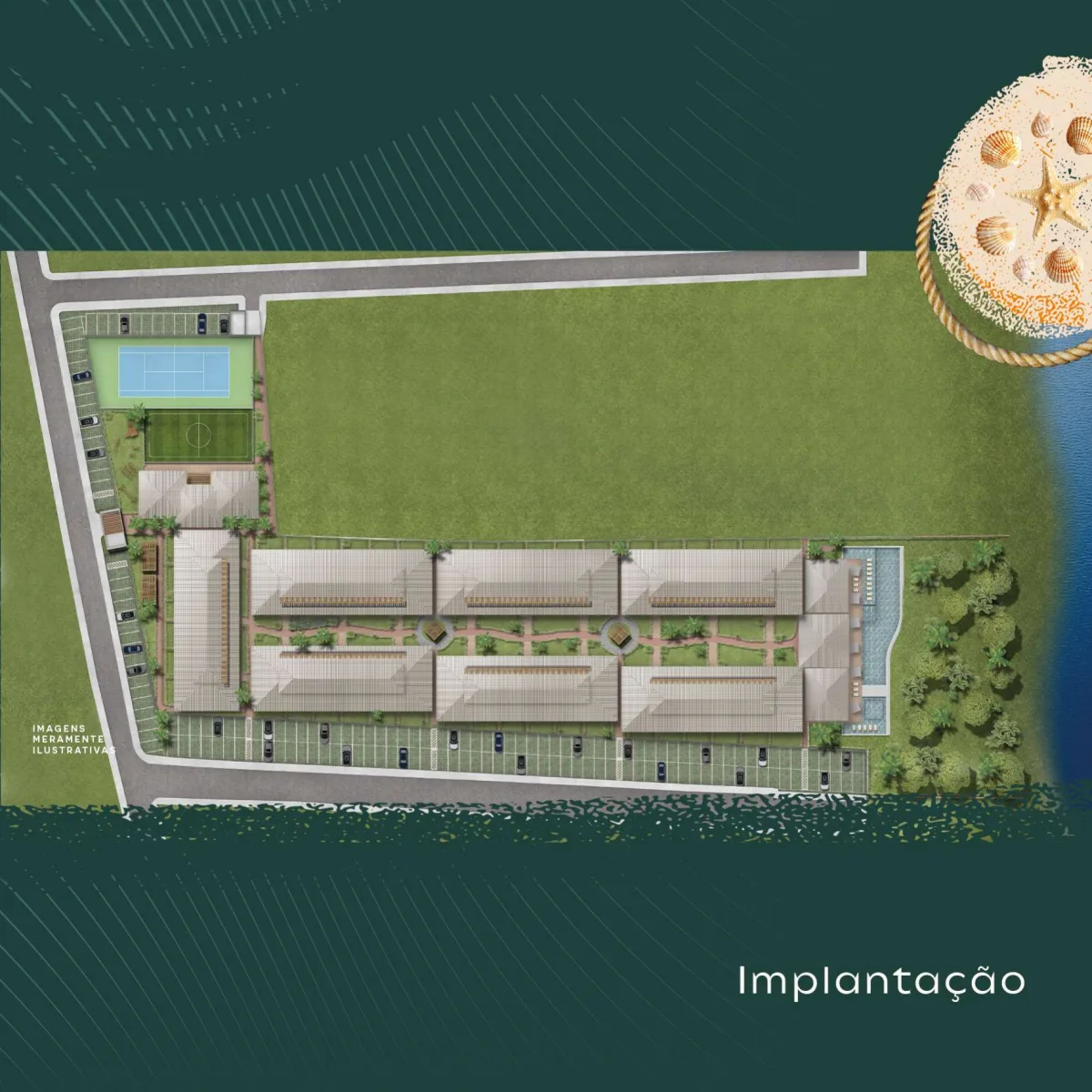 Implantação ilustrativa